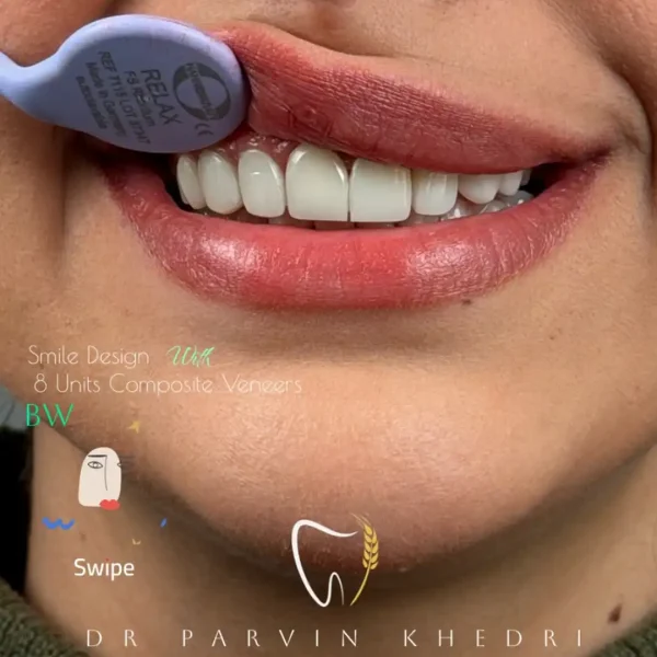 دندانپزشکی-دکتر-پروین-خدری-کرج